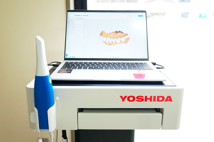 口腔内3Dスキャナー